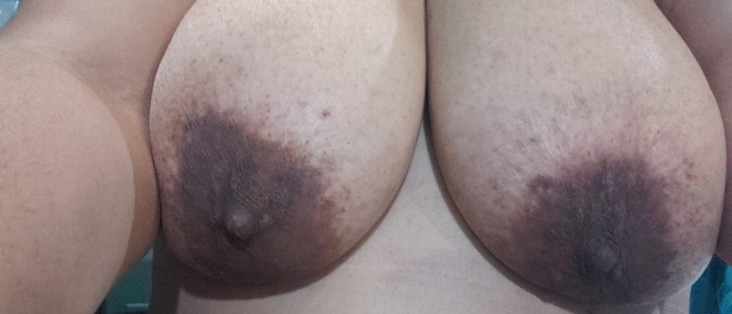 Wife's huge tits #ATDkhNo7